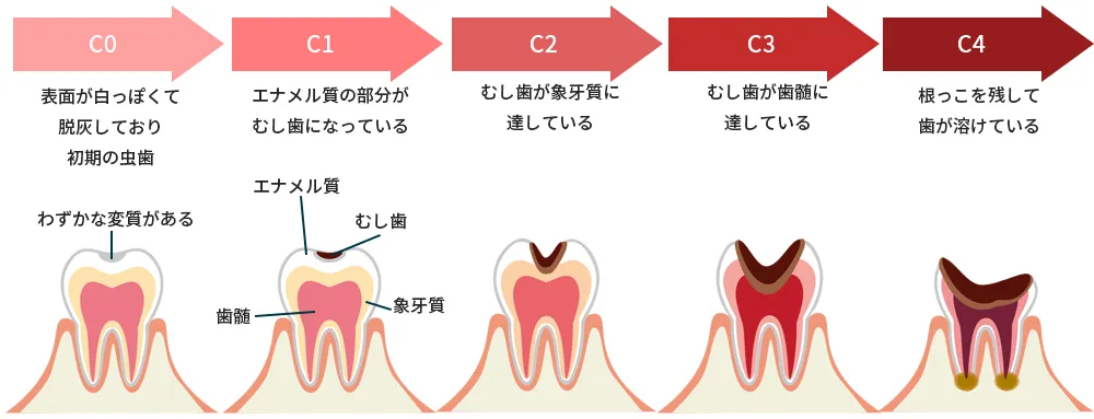 主な治療内容