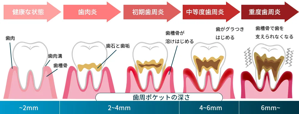主な治療内容